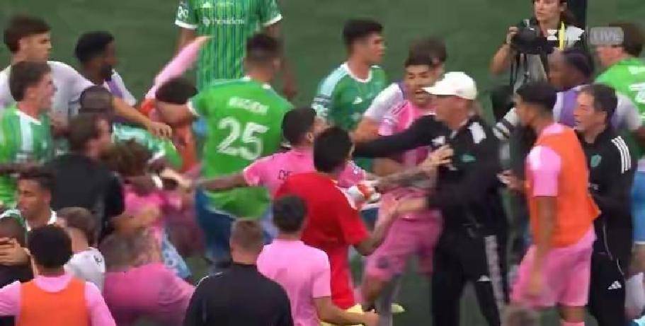 爱游戏登录入口-包含意外上演！球员突发伤情，球队不敌对手的词条